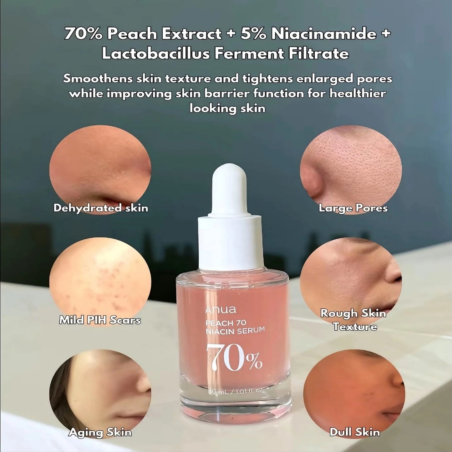 Anua Wonder Peach 70% Niacinamide Serum
